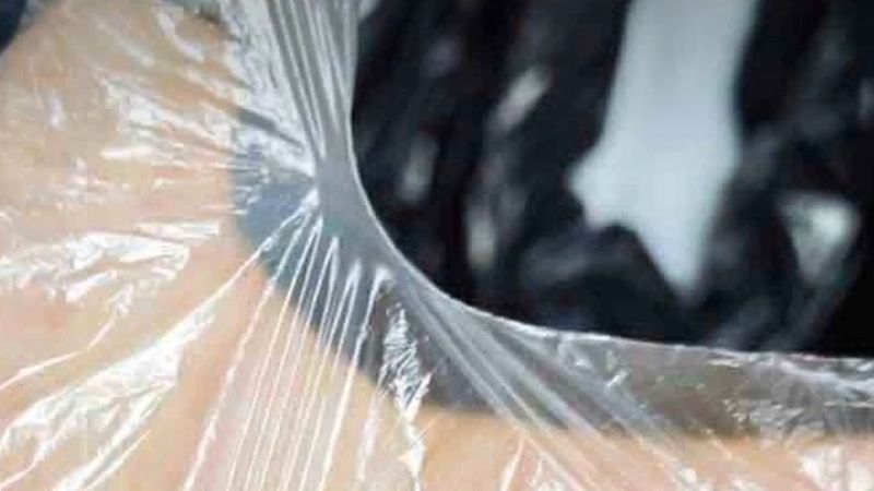 Kayseri Havalimanı'nda yaklaşık 25 bin canlı sülük ele geçirildi